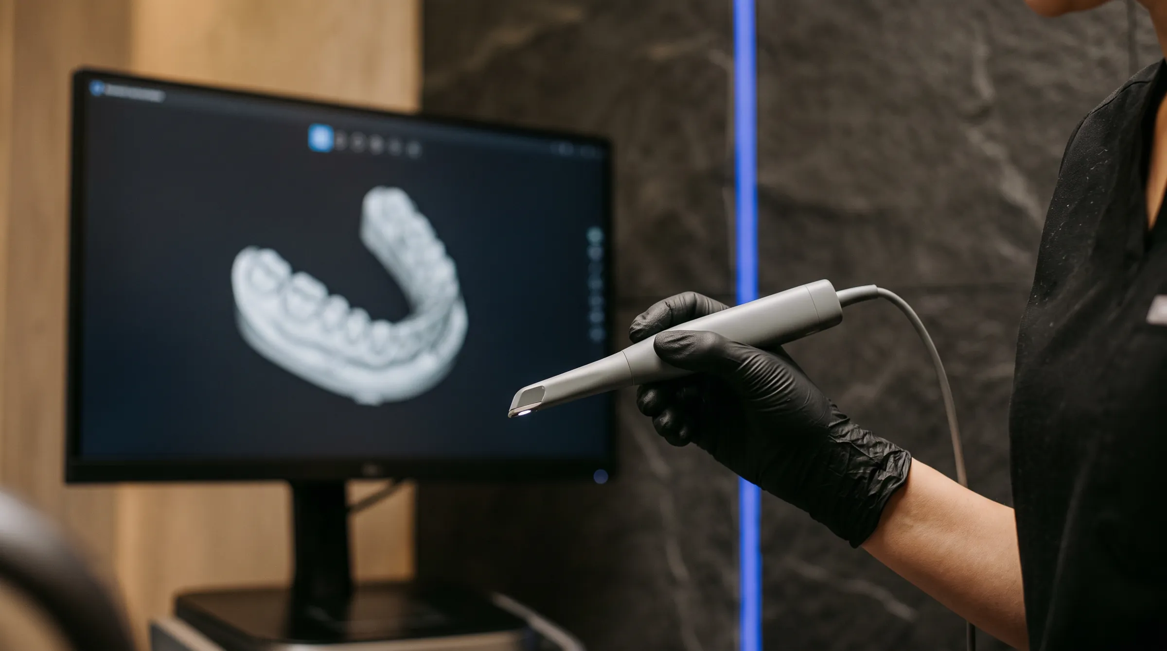 The intraoral scanner and a 3D model of the arch on screen